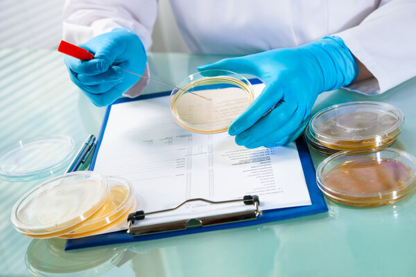 Agar plate with growing germs