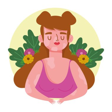 Mükemmel kusurlu kadın vitiligo ve çiçek çizgi film karakteri