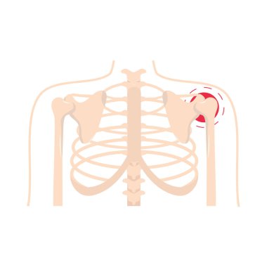 romatizma omuz ağrısı
