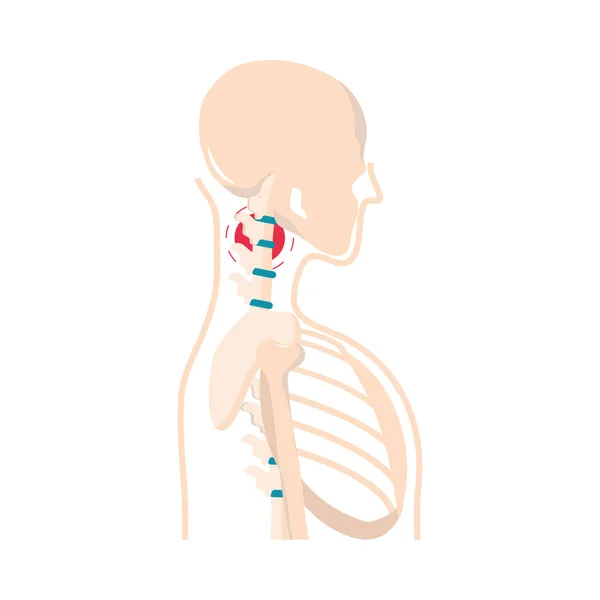 Reumatizmus arthritis fájdalom — Stock Vector