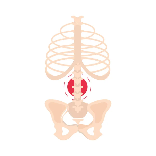 Rheumatism spine joint — Stock Vector