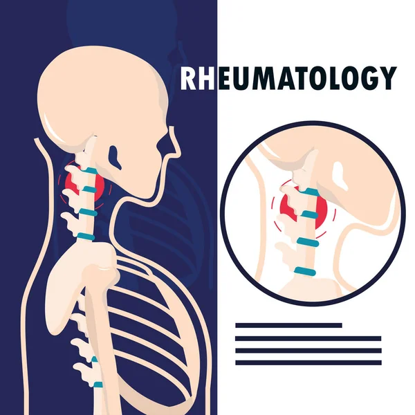 Reumatologia esqueleto humano —  Vetores de Stock