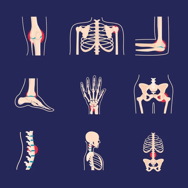 Conjunto de distúrbios reumatológicos —  Vetores de Stock