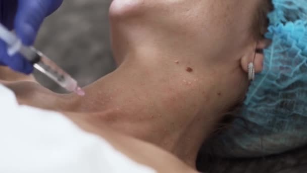 Frau bei der Mesotherapie-Injektion mit einer Spritze — Stockvideo