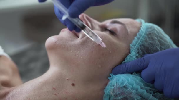 Donna in trattamento di mesoterapia iniettabile con siringa — Video Stock