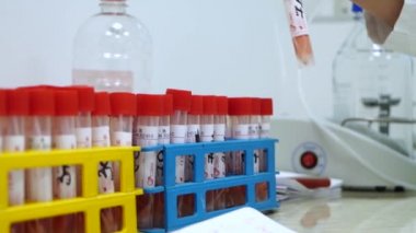 Laboratuvar elinde aşı olan test tüpleri test tüpü pkr testi yaptırır.