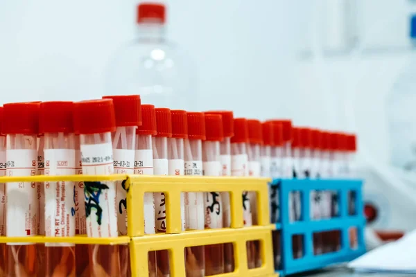 Yakın çekim pcr ile test tüpleri laboratuarda sonuç verir