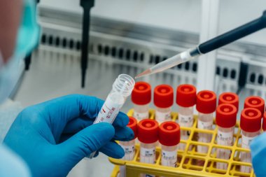 PCR test cihazı test tüpünden örnek analizi alıyor.