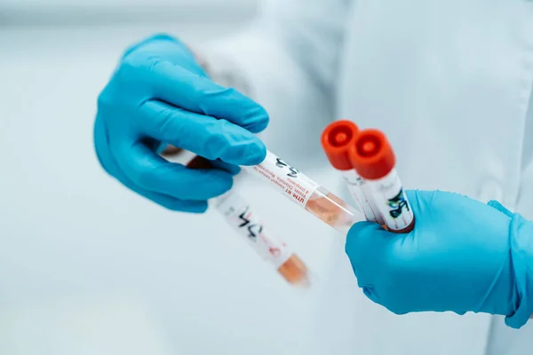 Laboratuvardaki doktor PCR test sonuçlarıyla test tüpleri tutuyor.