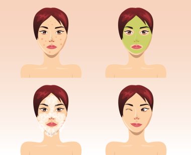 Beautiful woman face in process of acne treatment, vector clipart