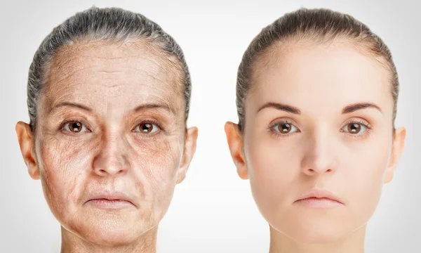 Aging process, rejuvenation anti-aging skin procedures old and young concept — Stock Photo, Image