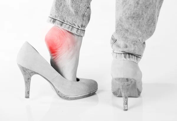 Dolor femenino en el talón con tacones altos — Foto de Stock