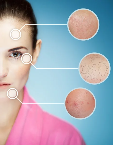 Konsep skincare dan masalah kulit wajah — Stok Foto