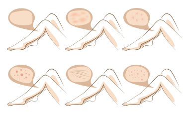Yordamlar cilt üzerinde anti-aging bacaklar kavramı