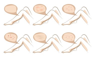 Legs concept of anti aging procedures on skin clipart
