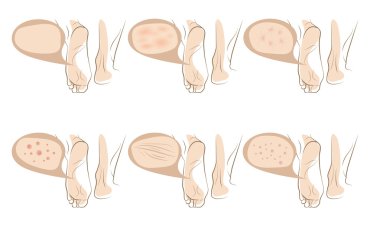 Yordamlar cilt üzerinde anti-aging kavramı ayak