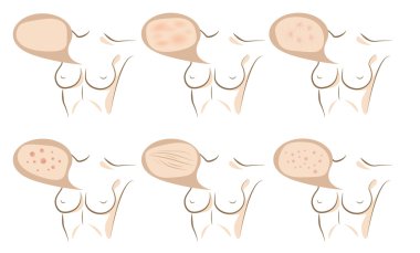 Yordamlar cilt üzerinde anti-aging vücut kavramı