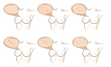 Body concept of anti aging procedures on skin clipart