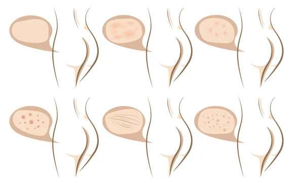 Концепция антивозрастных процедур на коже — стоковый вектор