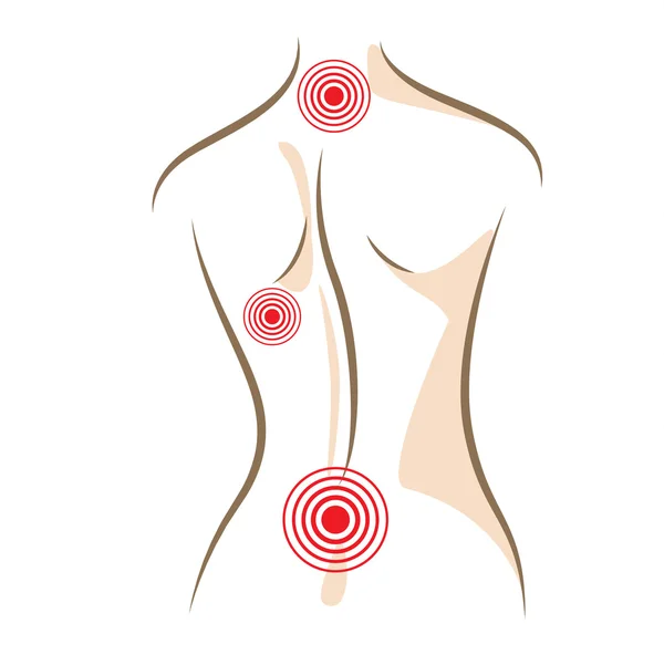 Kadın kavramı geri ağrı vektör kroki