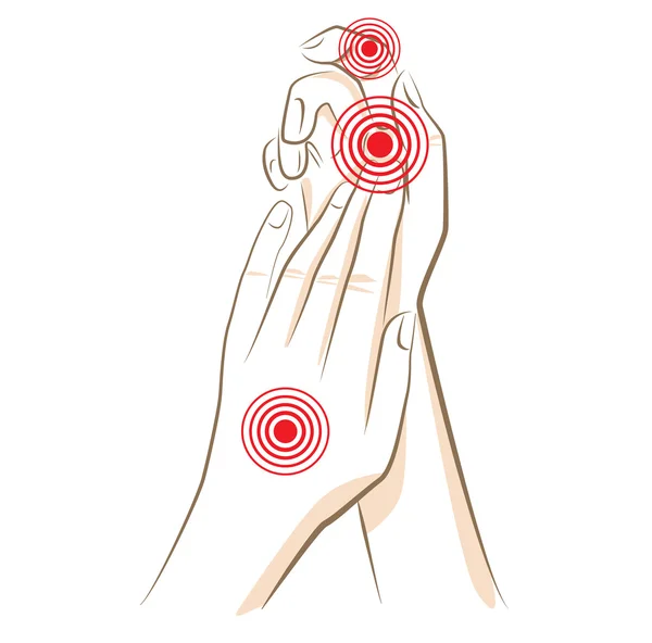 Concepto de dolor de la mujer en las manos, vector — Vector de stock