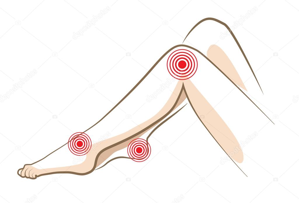 Concept of woman pain in legs, vector