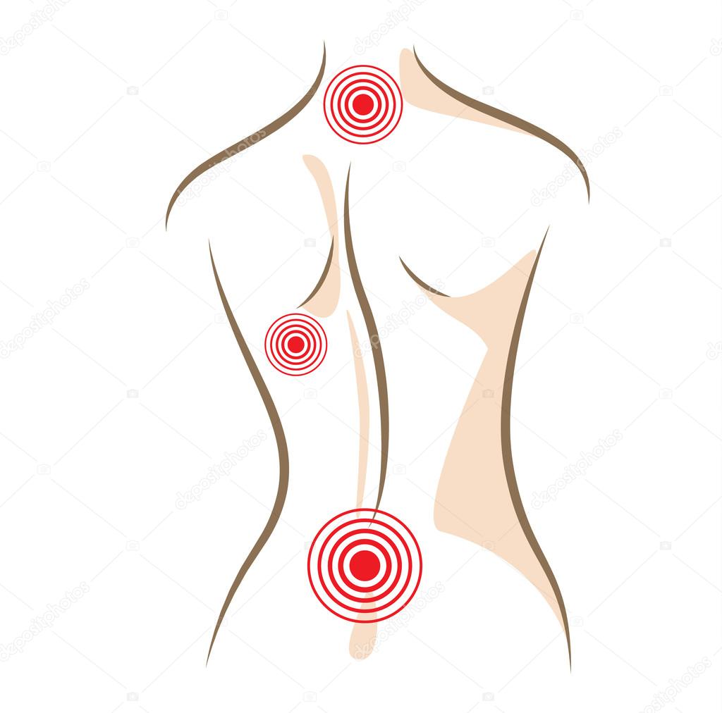 Concept of woman back pain vector sketch