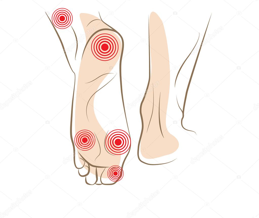 Concept of woman foot pain, vector