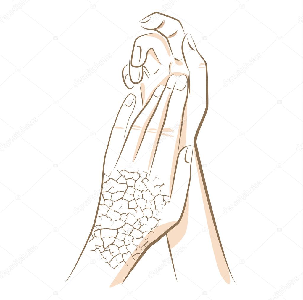 Concept of dry and cracked skin woman hands