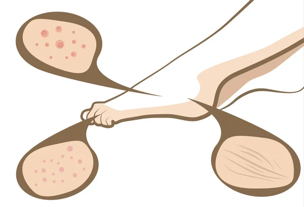 Проблема з шкірою ніг Векторна косметична концепція — стоковий вектор