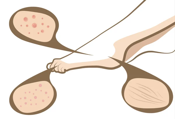 Stóp skóry problem wektor koncepcja kosmetyk — Wektor stockowy