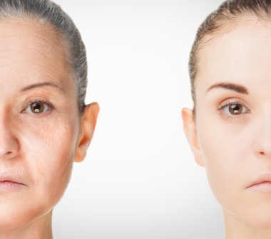 Yaşlanma süreci, gençleştirme anti-aging cilt yordamları