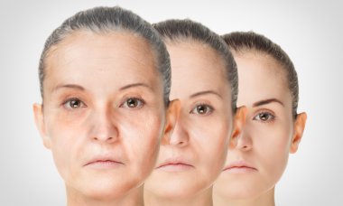 Yaşlanma süreci, gençleştirme anti-aging cilt yordamları