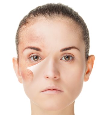 Cilt Bakımı tedavisi öncesi ve sonrası, güzellik kavramı