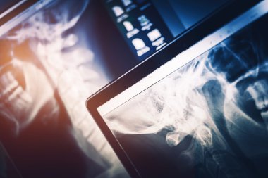 Xray tarama donanımları