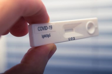 Coronavirus Salgını COVID 19 IgG IgM Rapid Test Kasedi. Antikorlar Algılama.