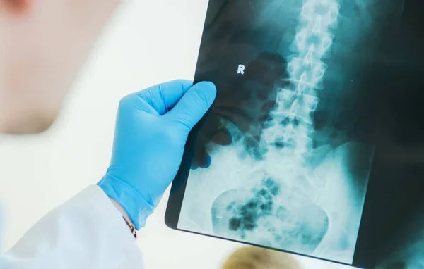 Der Radiologe Krankenhaus Untersucht Das Röntgenbild Seiner Patienten Bereich Der — Stockfoto