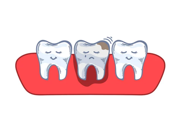 Dientes Encía Caries Dientes Dañados Dolor Muelas Dibujo Mano Ilustración — Archivo Imágenes Vectoriales