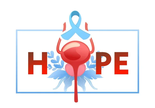 Konzeptionelle Medizinische Banner Landing Page Prostata Krankheit Krebs Hoffnung Und — Stockvektor