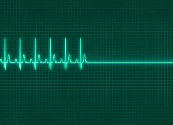 Una ilustración de electrocardiografía exitus en fondo de pantalla oscura — Foto de Stock