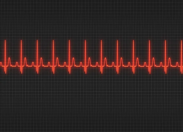 Ett EKG illustration i mörk skärmbakgrund — Stockfoto