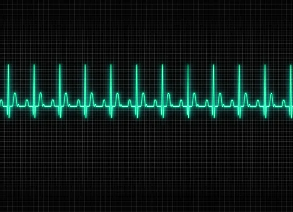 Egy EKG illusztráció, a háttér sötét képernyő — Stock Fotó