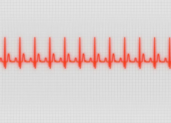 Egy EKG illusztráció háttérben fény képernyő — Stock Fotó