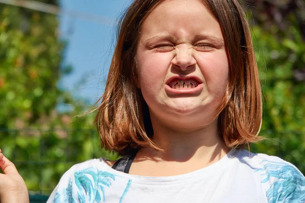 一个年轻的女孩做了一个有趣的脸 她闭上了眼睛 张大了嘴 露出了牙齿上的假牙 — 图库照片
