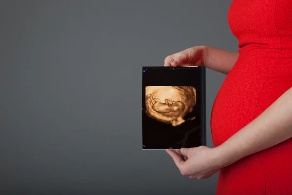 Zwangere vrouw weergegeven: echografie foto van de baby — Stockfoto