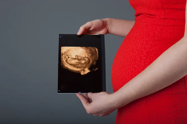 Zwangere vrouw weergegeven: echografie foto van de baby — Stockfoto