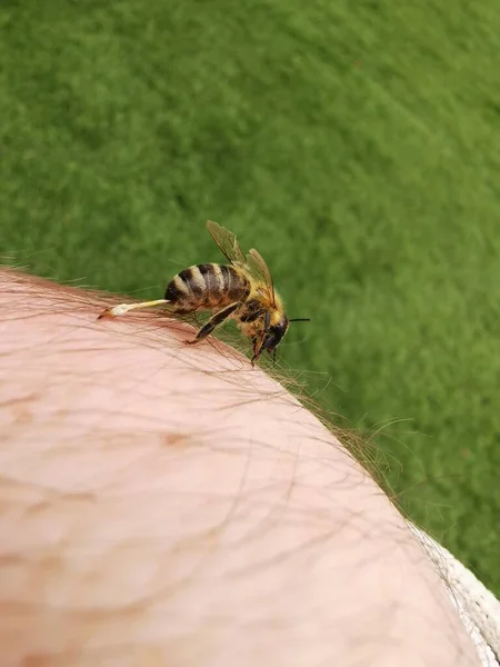 Лечение Пчелиными Укусами Апитерапия — стоковое фото