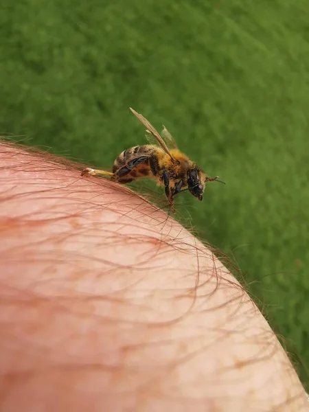 Traitement Avec Piqûres Abeilles Apithérapie — Photo