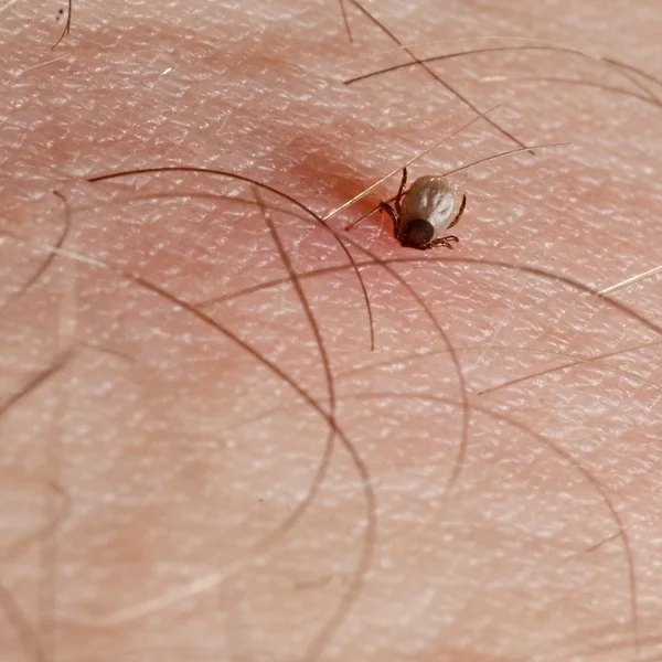 Marque con su cabeza pegada en la piel humana — Foto de Stock