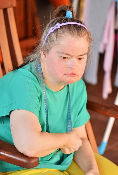 Woman with down syndrome — Stock Photo, Image